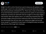 Ninja's tweet from March 27, 2024, in which he revealed a melanoma diagnosis (Image via X)